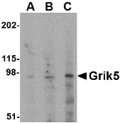 IHC-plus™ GRIK5 / KA2 Antibody