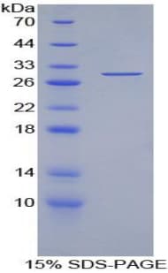 Human TOR3A Protein (Recombinant His-T7)