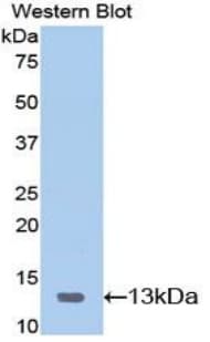 Serum Amyloid A Antibody (aa20-122)
