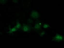 Monoclonal Mouse anti-Human SOCS3 Antibody (clone OTI11C5, IF, WB)