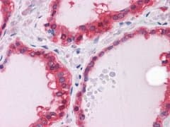 ST13 Antibody (clone 3B10)