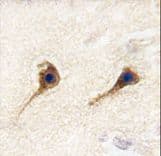 SARS2 / SYS Antibody (aa160-188)