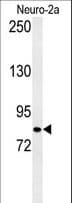 HID1 / C17orf28 Antibody (aa567-595)