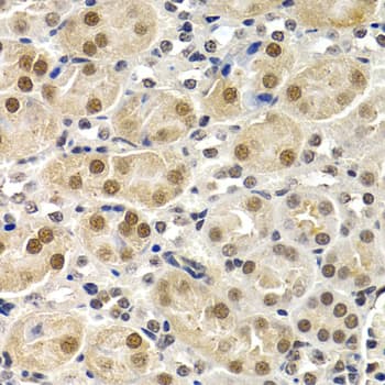Polyclonal Rabbit anti-Human ID3 Antibody (IHC, IF, WB)