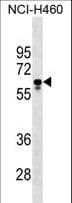 PGS1 Antibody (aa272-299)