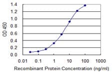 Monoclonal Mouse anti-Human HSD17 / HSD17B1 Antibody (clone 2E5, WB)