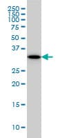 Monoclonal Mouse anti-Human RPRD1A Antibody (clone 1B8, WB)