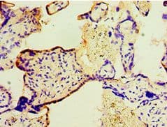 TGM2 / Transglutaminase 2 Antibody (aa438-687)