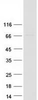 Human ARMC8 Protein (Recombinant Myc-DDK (Flag))