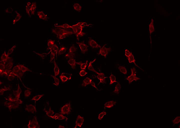 Polyclonal Rabbit anti-Human CHEMR23 / CMKLR1 Antibody (IF, WB)