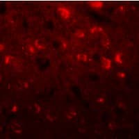IHC-plus™ TMEM59L Antibody