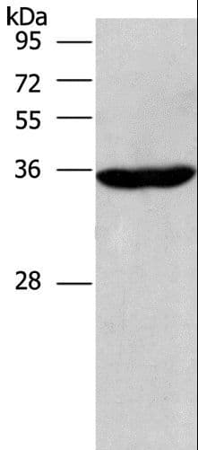 CIAPIN1 / Anamorsin Antibody