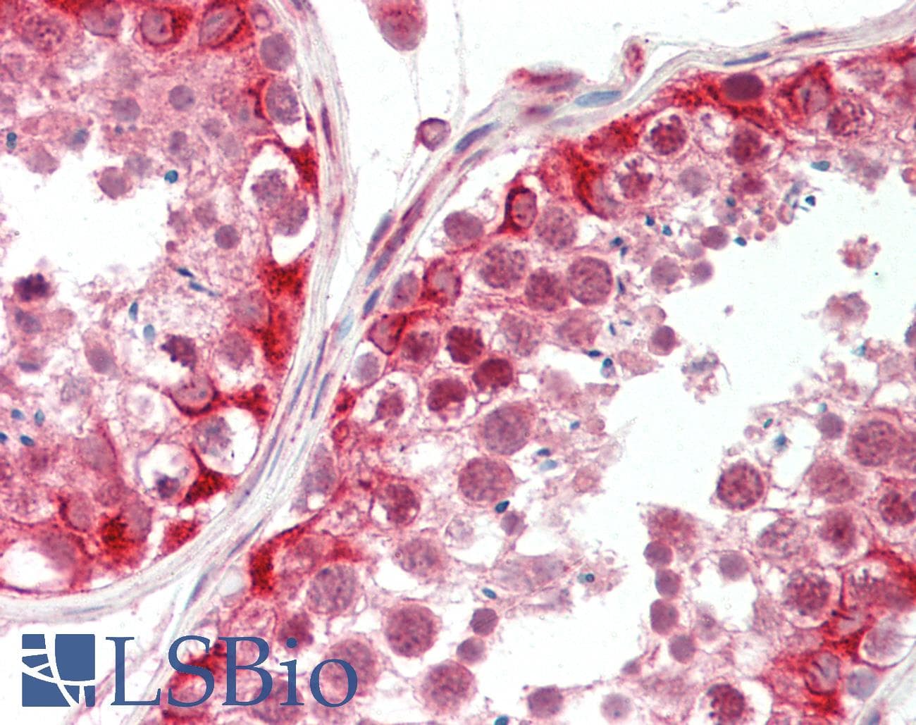 ATAD2 Antibody (aa1205-1254)