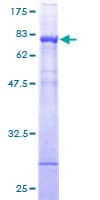 Human NADK / NAD Kinase Protein (Recombinant GST)