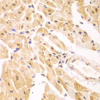 Polyclonal Rabbit anti-Human PSMD2 Antibody (IHC, IF, WB)