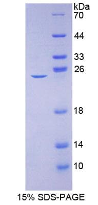Mouse CACNA1C / Cav1.2 Protein (Recombinant His-S)