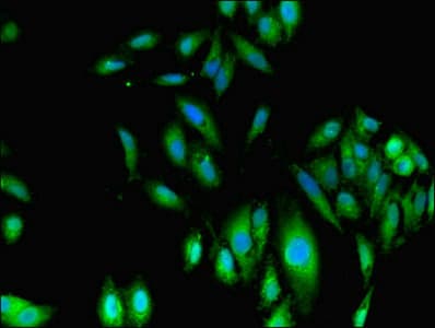 FH / Fumarase / MCL Antibody