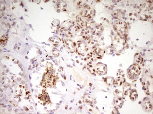 MEF2D Antibody (aa1-282, clone OTI10B4)