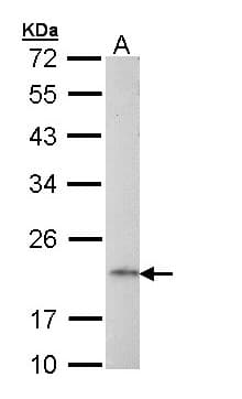 IHC-plus™ Polyclonal Rabbit anti-Human AP1S2 Antibody (IHC, WB)