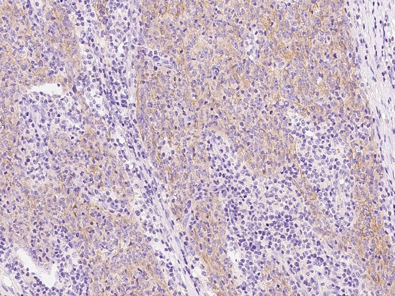 KRT10 / CK10 / Cytokeratin 10 Antibody