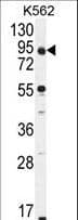 Polyclonal Rabbit anti-Human PPP1R21 / KLRAQ1 Antibody (aa207-236, IHC, WB)