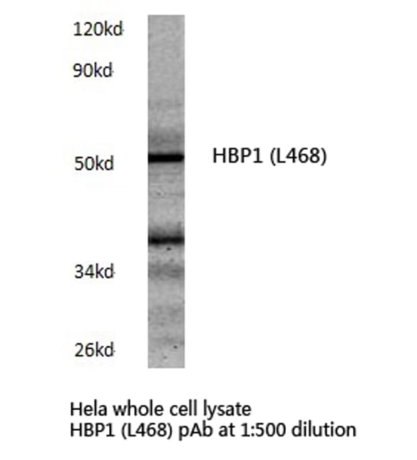 HBP1 Antibody (Leu468)