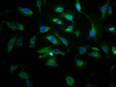 Polyclonal Rabbit anti-Human ABCC8 / SUR1 Antibody (IHC, IF)