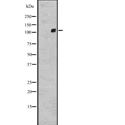 ADGRG2 / GPR64 Antibody