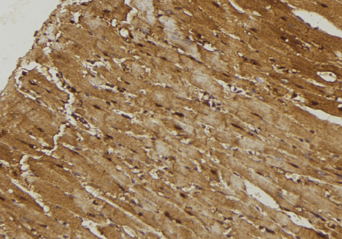 MRPL21 Antibody