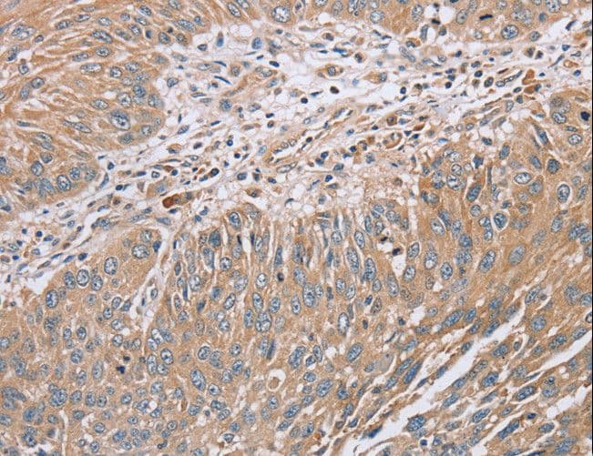 RAB8B Antibody
