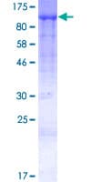 Human TRAPPC9 Protein (Recombinant GST)
