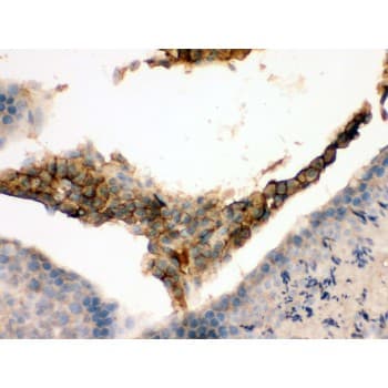 GNAQ Antibody (aa102-138)