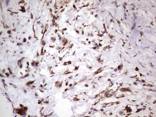 Peripherin Antibody (clone OTI1E10, Carrier-free)