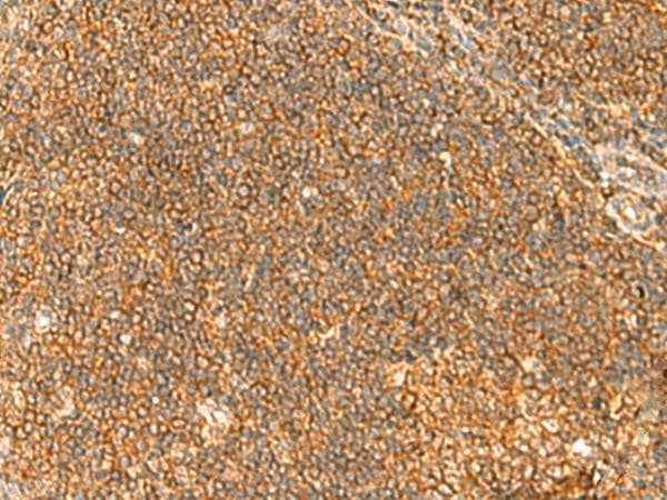 Polyclonal Rabbit anti-Human TBCK / TBCKL Antibody (IHC)