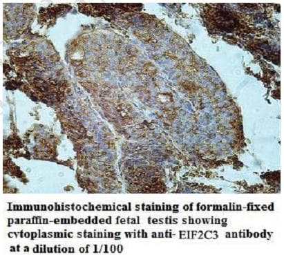 AGO3 / EIF2C3 Antibody