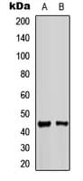KCNJ11 / Kir6.2 Antibody (Internal)