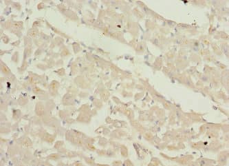 ZFYVE16 Antibody