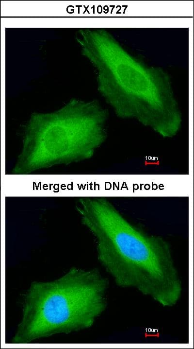 DDX3 Antibody (aa70-346)