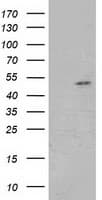Monoclonal Mouse anti-Human GSS / Glutathione Synthetase Antibody (clone OTI2G3, WB)