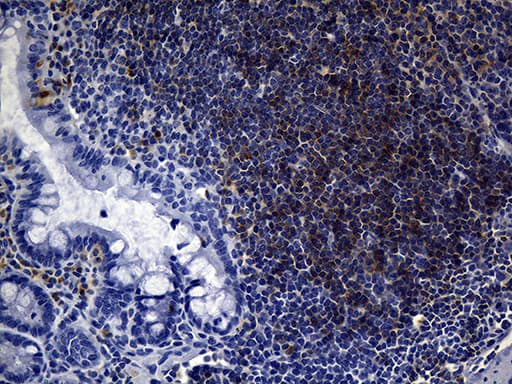FCER2 / CD23 Antibody (aa48-321, clone UMAB101)