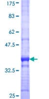 Human MOX / MOXD1 Protein (Recombinant GST, N-terminus)