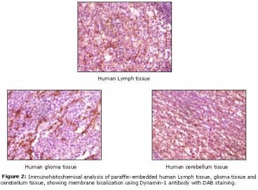 DNM1 / Dynamin Antibody (clone 3G4B6)