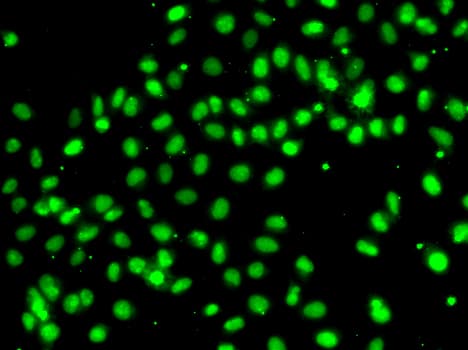 Polyclonal Rabbit anti-Human MEPCE Antibody (IHC, IF, WB)