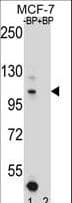 HIPK1 Antibody (aa893-922)