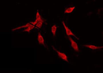 Polyclonal Rabbit anti-Human ALS2CR11 Antibody (IF, WB)