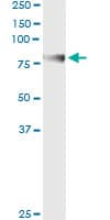 Monoclonal Mouse anti-Human CD105 Antibody (clone 4C11, WB)
