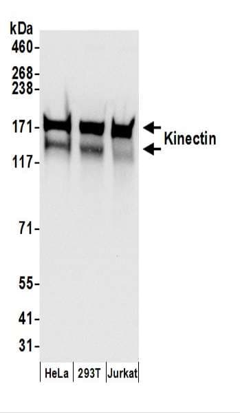 KTN1 / Kinectin Antibody (aa1307-1357)