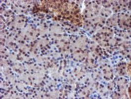 TIP48 / RUVBL2 Antibody (clone OTI1D9)