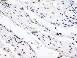 CRYAB / Alpha B Crystallin Antibody (clone OTI6G5)