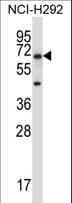 PODXL2 / Endoglycan Antibody (aa573-602)